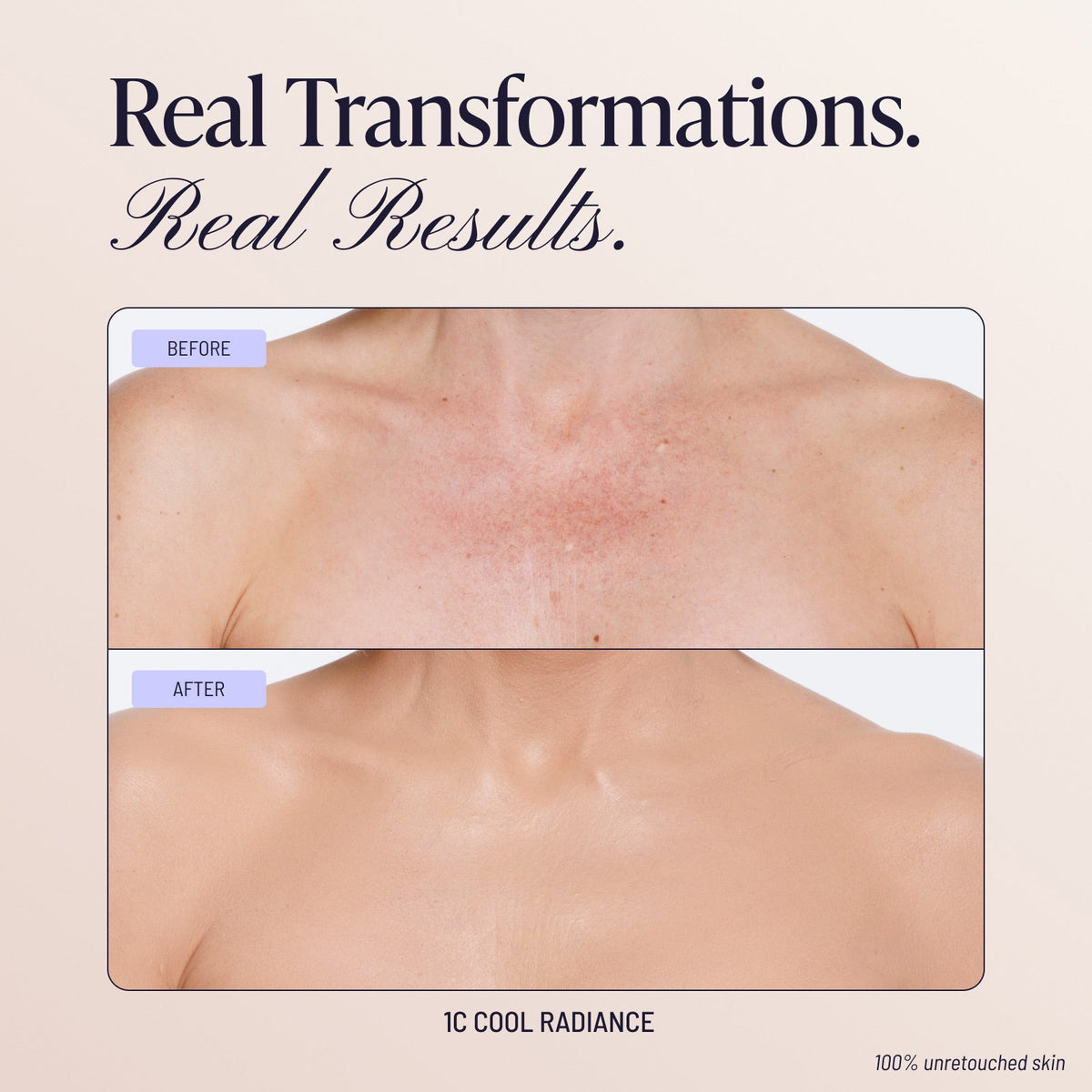 Body Coverage Perfector