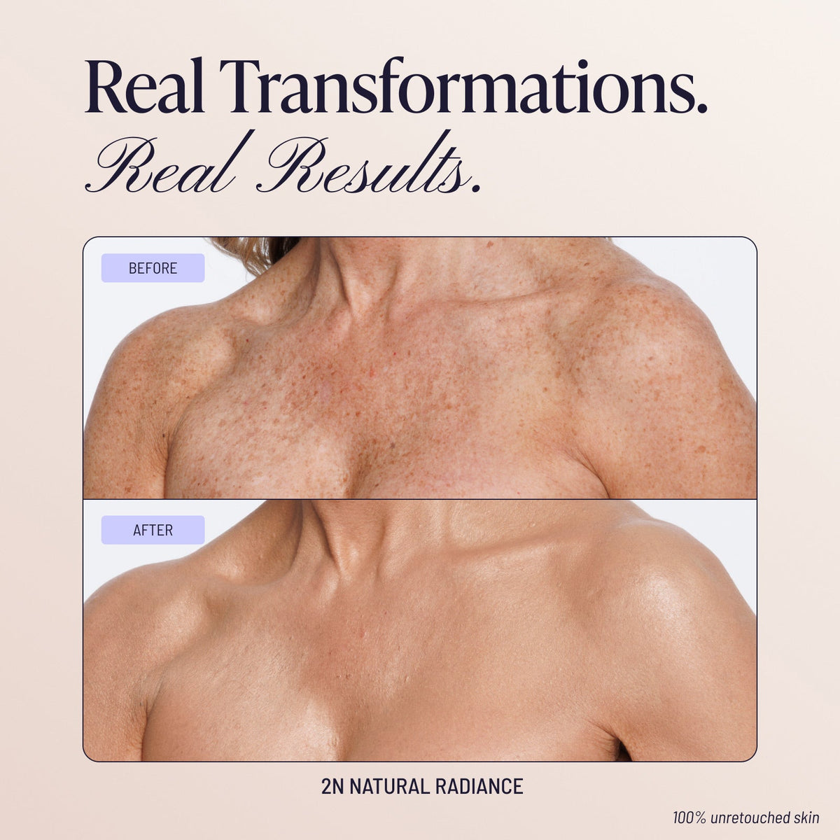 Body Coverage Perfector