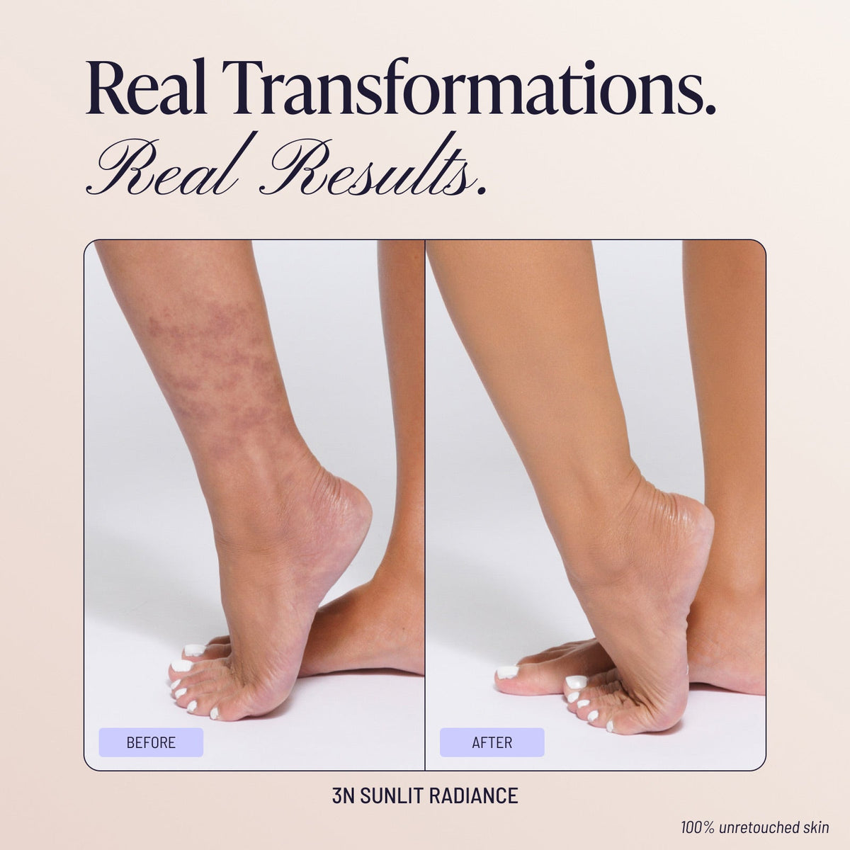Body Coverage Perfector