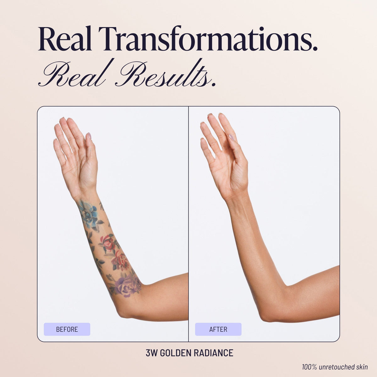 Body Coverage Perfector