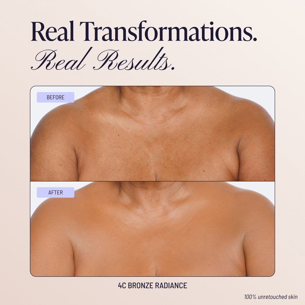 Body Coverage Perfector